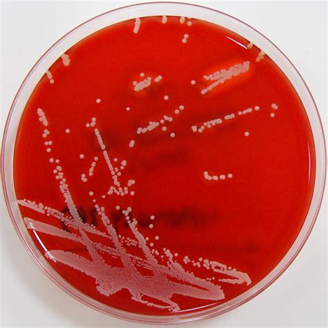 staphylococcus haemolyticus on blood agar